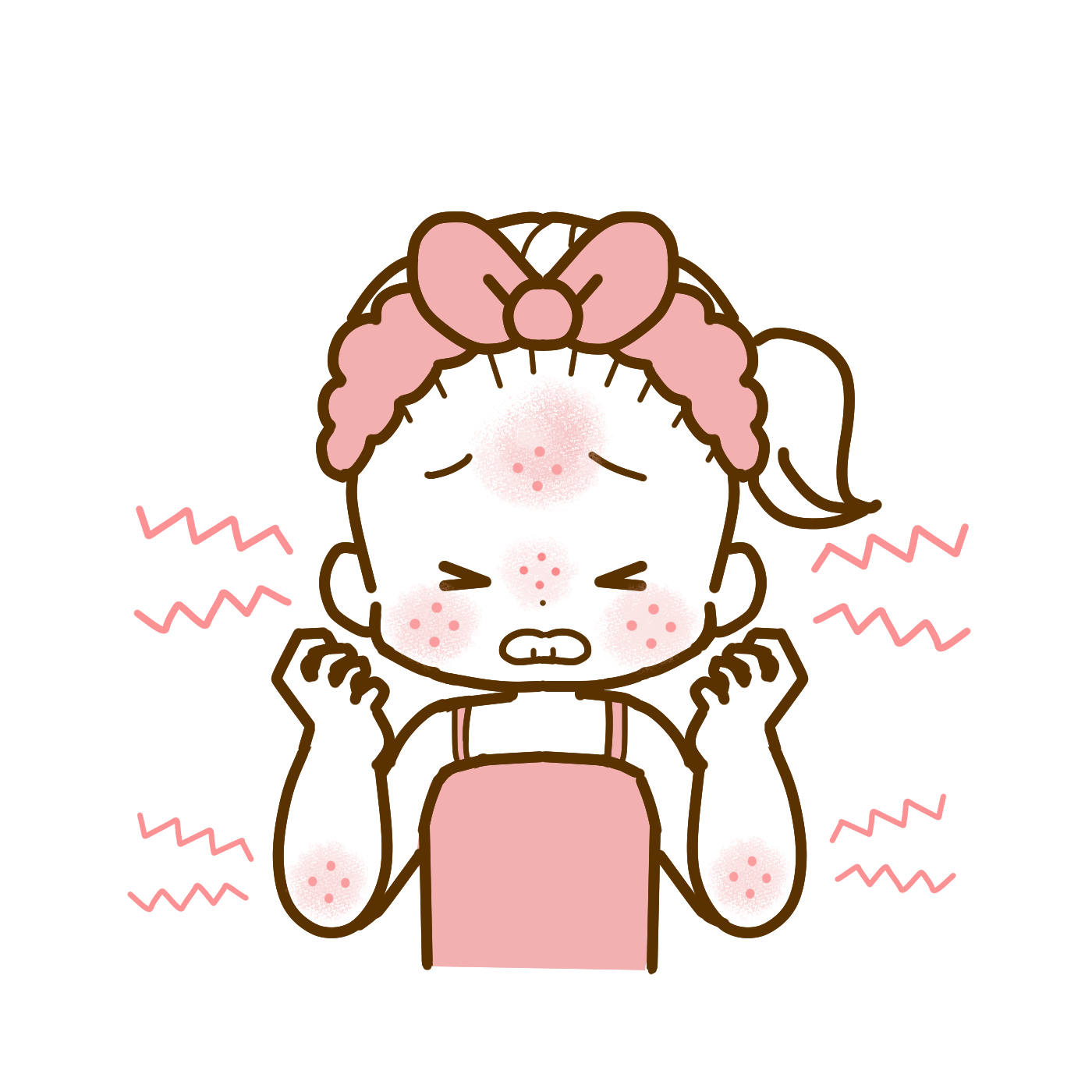 原因不明のじんましん。タウロミンで治まってます